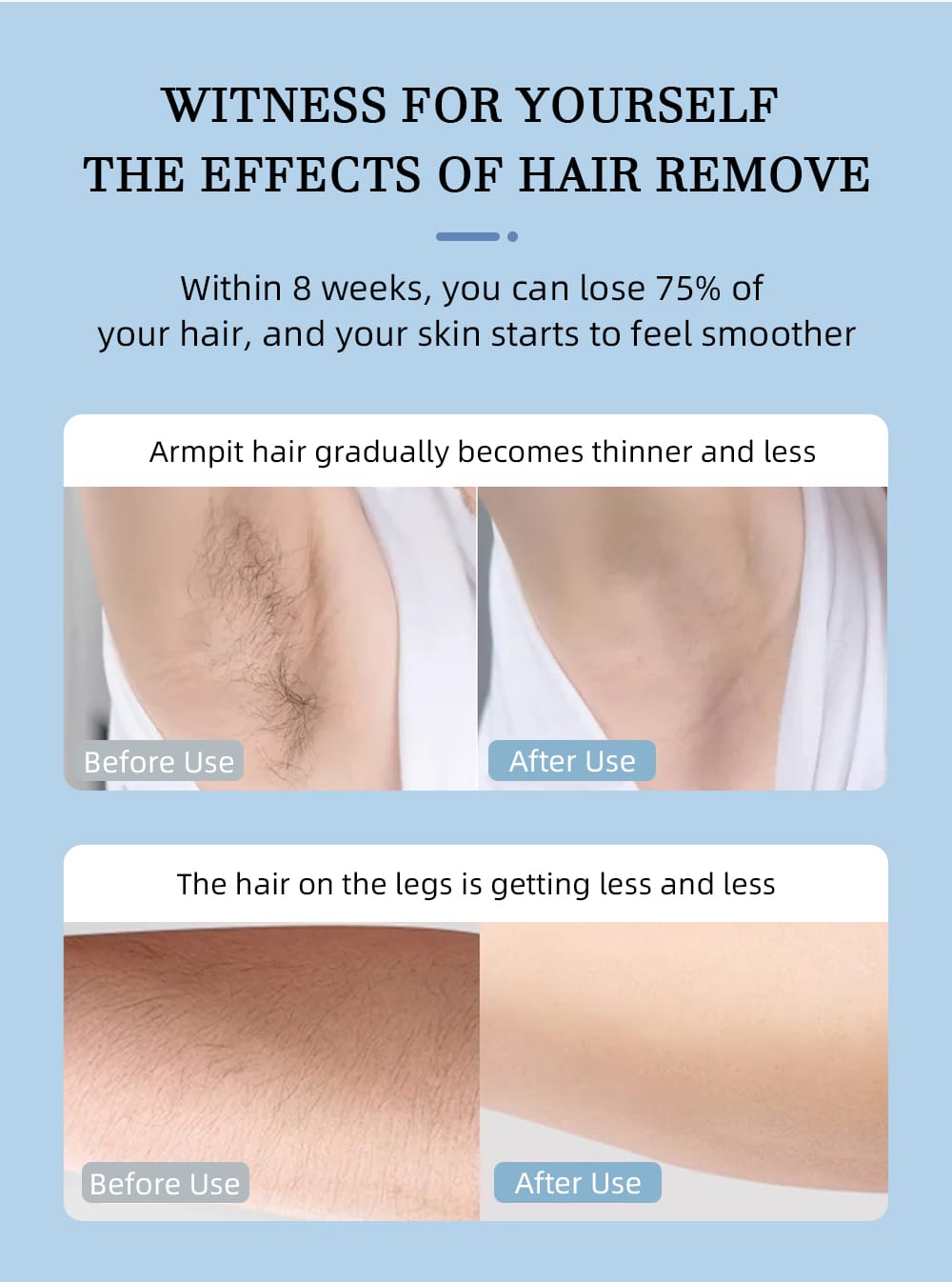 IPL Laser Hair Removal for Home use - BAS Kuwait